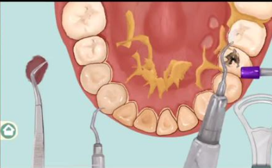 小小收纳唇红齿白通关秘籍
